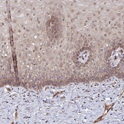FUT10 Antibody, Novus Biologicals 0.1mL; Unlabeled:Antibodies, Polyclonal